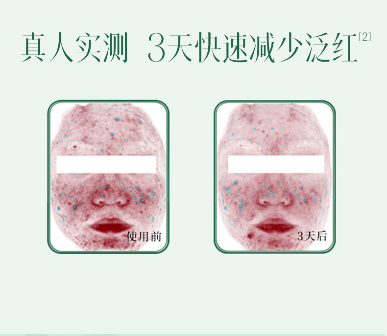 内容图片
